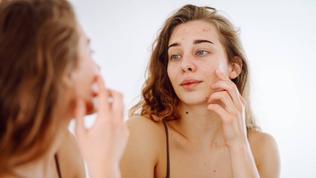 Young woman examining acne-prone skin in a bathroom mirror.