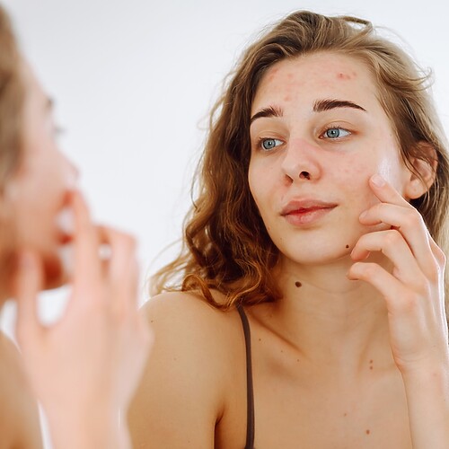 Young woman examining acne-prone skin in a bathroom mirror.